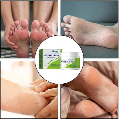 South Moon 42% Urea and 2% Salicylic Acid cream jar, moisturizing skincare product with exfoliating properties